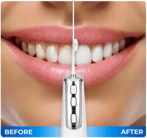 How to use Miracle Smile Magic Flosser